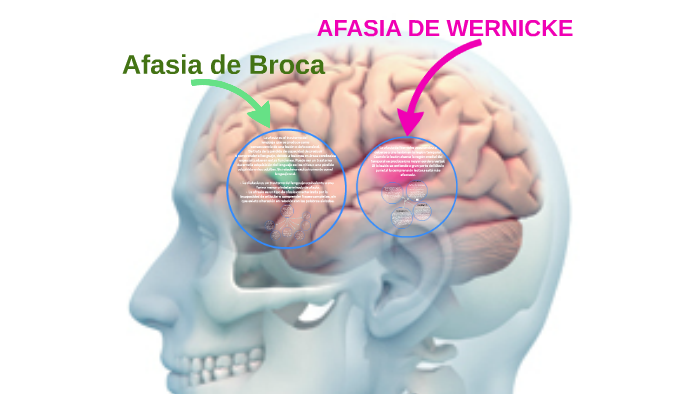 Afasia saiba o que é sintomas e tratamento Anatomia de uma leitora